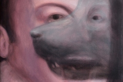 Ragazzo-morso-da-un-cane